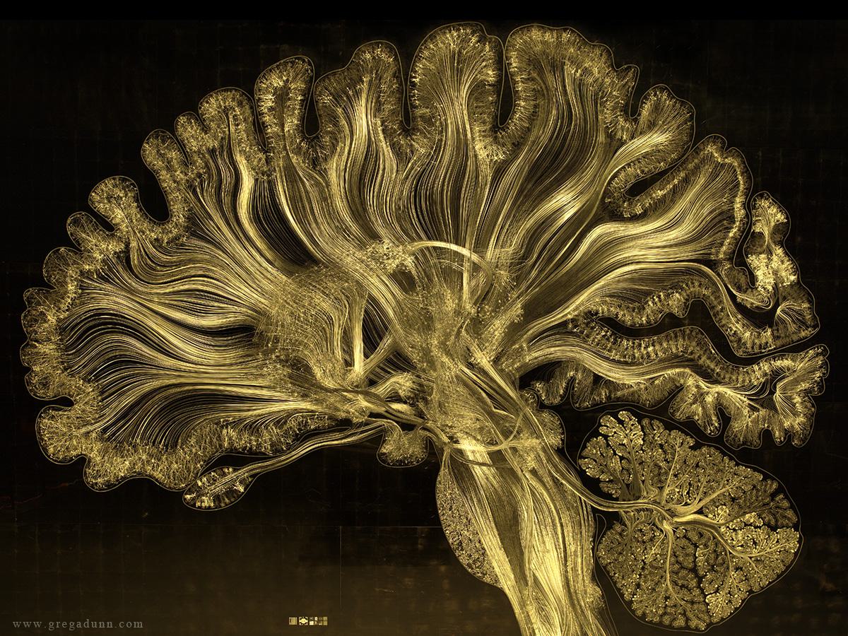 Gold Leaf Prints of the Human Brain by Greg Dunn